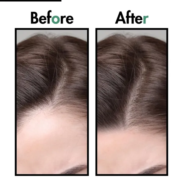 Hair_Growth_Serum