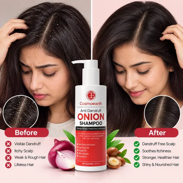 Cosmoearth_Anti_Dandruff_Onion_Shampoo_Red_Onion_Extract_100_Ml
