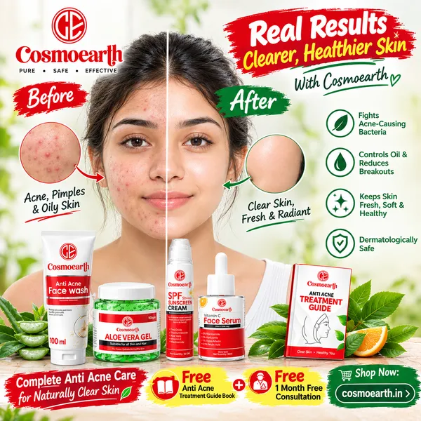 Cosmoearth_Anti_Acne_Skincare_Box_For_Acne_Prone_Skin_4_Piece_Set