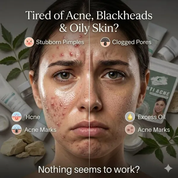 Anti_Acne_Face_Mask_For_Women_And_Men_50_Gm_For_Oily_And_Acne_Prone_Skin_Helps_To_Prevent_Pimples_Breakouts