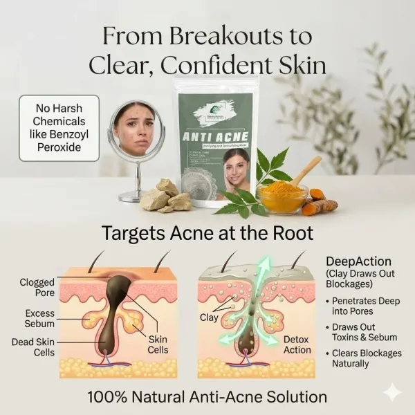 Anti_Acne_Face_Mask_For_Women_And_Men_50_Gm_For_Oily_And_Acne_Prone_Skin_Helps_To_Prevent_Pimples_Breakouts