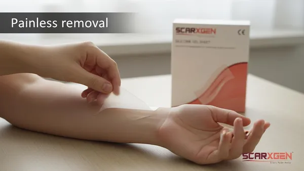 Scarxgen_Silicone_Gel_Sheet_5cm_x_5cm