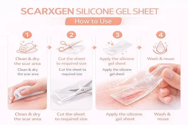 Scarxgen_Silicone_Gel_Sheet_6cm_x_15cm