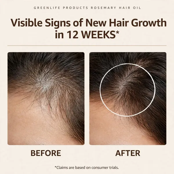 Greenlife_Rosemary_Hair_And_Scalp_Care_Oil_-_Pack_of_2