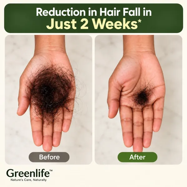 Green_Life_Herbal_Hair_Regrowth_Oil