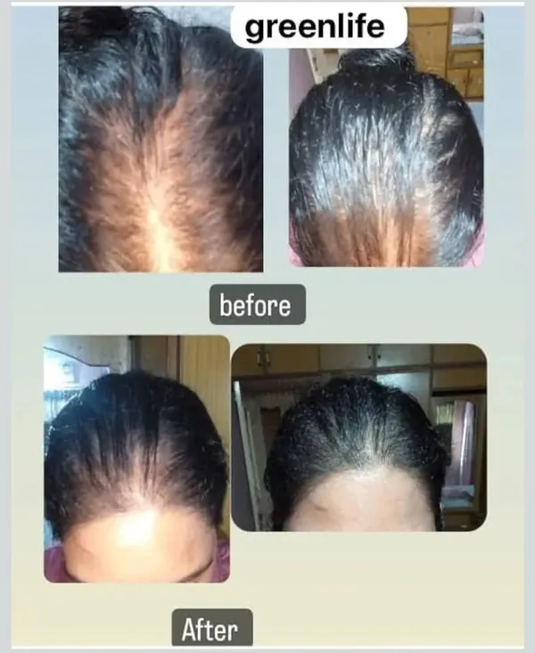 Green_Life_Herbal_Hair_Regrowth_Oil