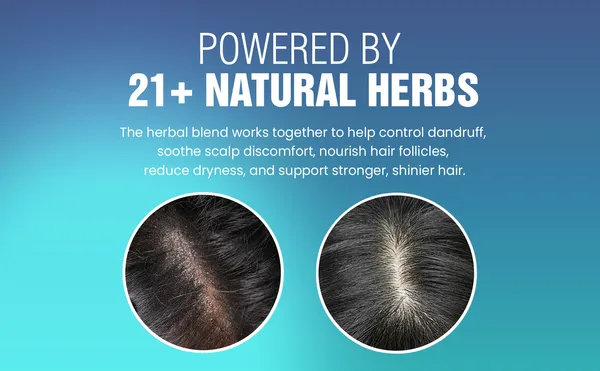 Glowvita_Anti_Dandruff_Hair_Oil