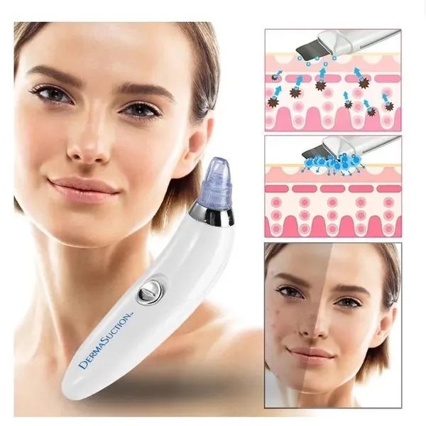 Derma_Suction_Multi_Function_Whitehead___Blackhead_Remover_Tool