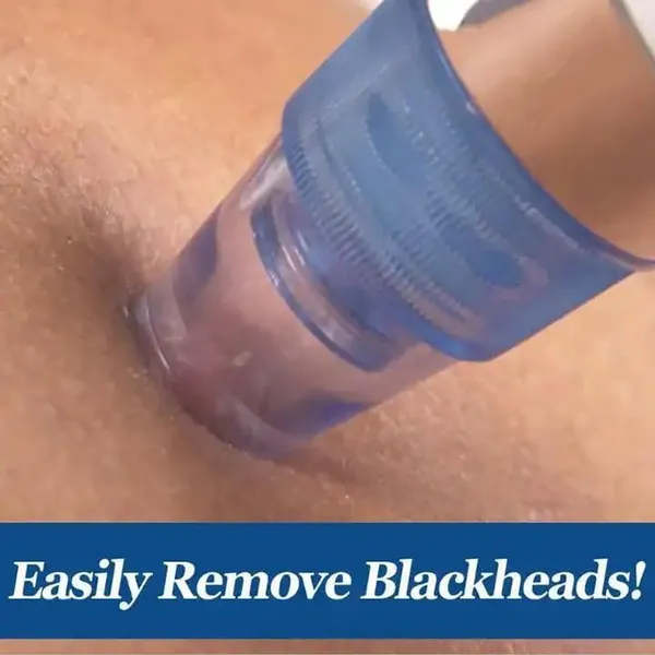 Derma_Suction_Multi_Function_Whitehead___Blackhead_Remover_Tool