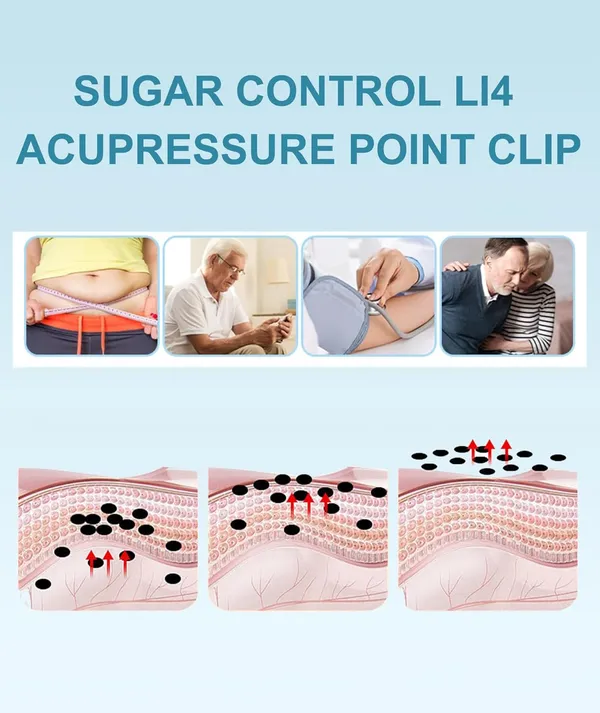 Buy_1_Get_1_Sugar_Control_Li4_Acupressure_Point_Clip,_Sugar_Control_Acupressure_Clip_Hand_Acupressure_Clip,_Natural_Headache_Clip_Wearable_Supporting_Acupressure_Relaxation_Acupressure_Tools_Wearable_(Black)_-_PACK_OF_2
